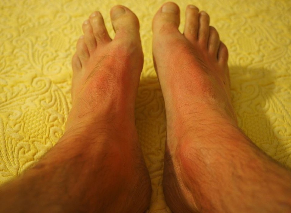 Protection UV homme, la crème solaire jusqu'au bout des doigts de pieds